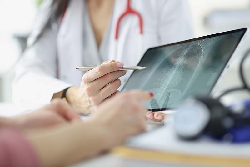 Chest X-ray displayed on tablet for B-Reader pneumoconiosis interpretation